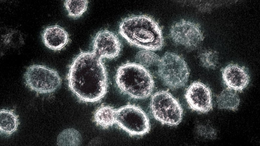 مدفيديف يحذر من ظهور فيروسات جديدة مصطنعة في العالم ويتهم واشنطن